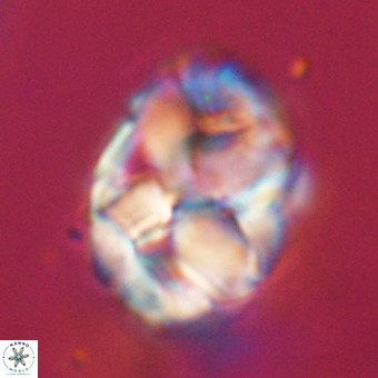 Chiphragmalithus calathus VR 29796