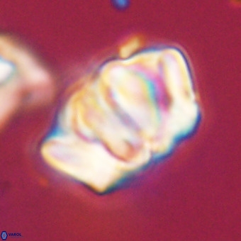 Chiphragmalithus calathus VR 29797