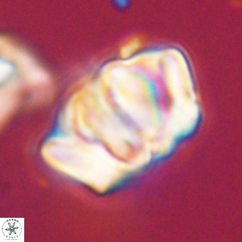 Chiphragmalithus calathus VR 29797