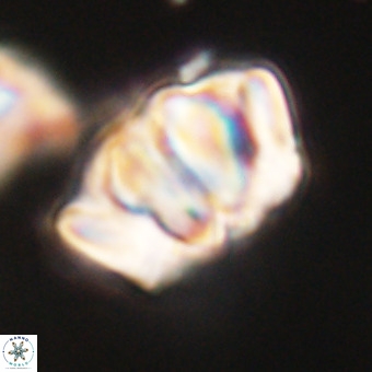 Chiphragmalithus calathus VR 29798
