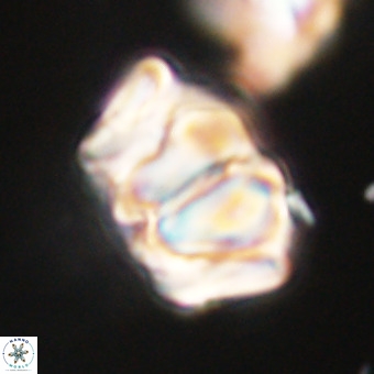 Chiphragmalithus calathus VR 29799