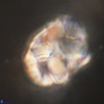 Chiphragmalithus calathus VR 29790