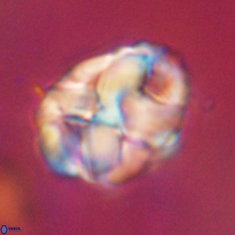 Chiphragmalithus calathus VR 29792