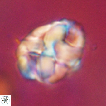 Chiphragmalithus calathus VR 29792