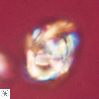 Chiphragmalithus calathus VR 29804