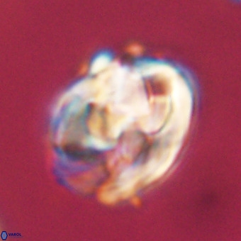 Chiphragmalithus calathus VR 29805