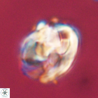 Chiphragmalithus calathus VR 29805