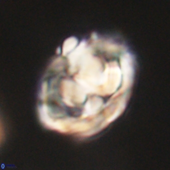 Chiphragmalithus calathus VR 29807