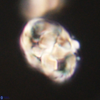 Chiphragmalithus calathus VR 29808