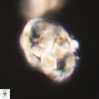 Chiphragmalithus calathus VR 29808
