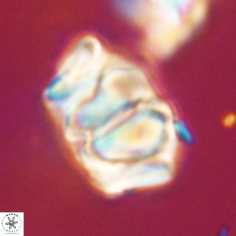 Chiphragmalithus calathus VR 29800