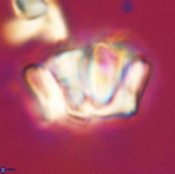Chiphragmalithus calathus VR 29801