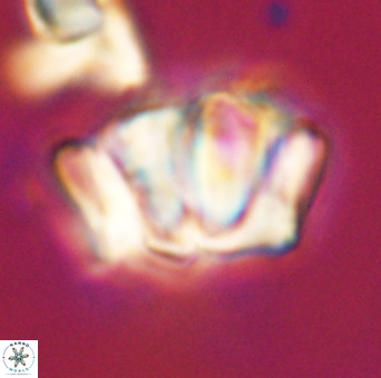 Chiphragmalithus calathus VR 29801