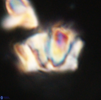 Chiphragmalithus calathus VR 29802