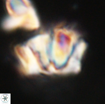 Chiphragmalithus calathus VR 29802