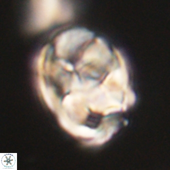 Chiphragmalithus calathus VR 29810