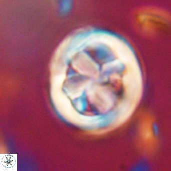 Chiphragmalithus calathus VR 30315