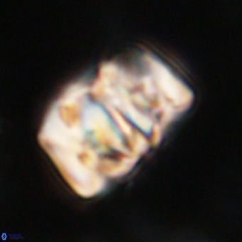 Chiphragmalithus calathus VR 30318