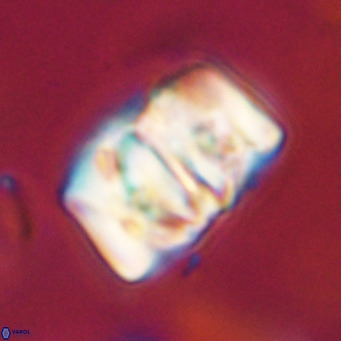 Chiphragmalithus calathus VR 30319