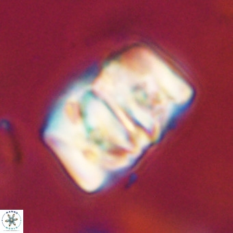 Chiphragmalithus calathus VR 30319