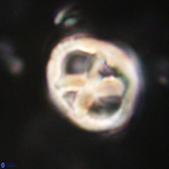 Chiphragmalithus calathus VR 30311