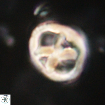 Chiphragmalithus calathus VR 30311