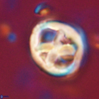 Chiphragmalithus calathus VR 30312