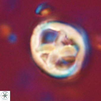 Chiphragmalithus calathus VR 30312