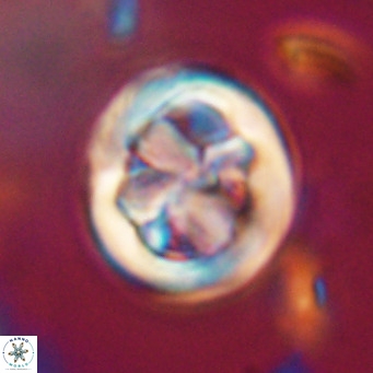 Chiphragmalithus calathus VR 30313