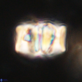 Chiphragmalithus calathus VR 30325