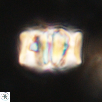 Chiphragmalithus calathus VR 30325