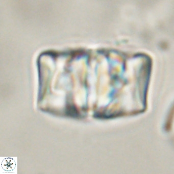Chiphragmalithus calathus VR 30326