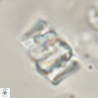 Chiphragmalithus calathus VR 30328