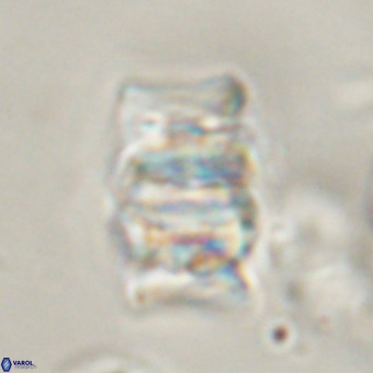 Chiphragmalithus calathus VR 30329