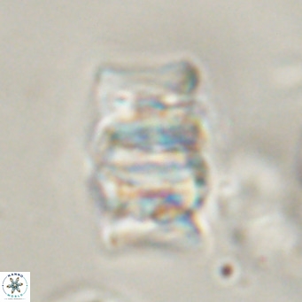 Chiphragmalithus calathus VR 30329