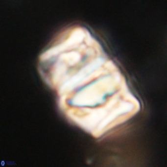Chiphragmalithus calathus VR 30322