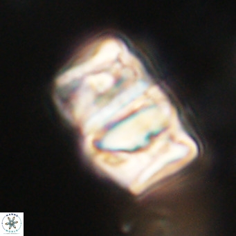 Chiphragmalithus calathus VR 30322