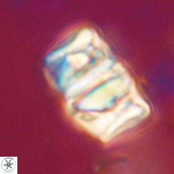 Chiphragmalithus calathus VR 30323