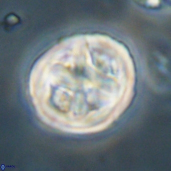 Chiphragmalithus calathus VR 30335
