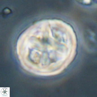 Chiphragmalithus calathus VR 30335