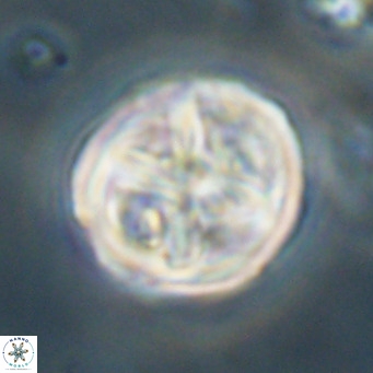 Chiphragmalithus calathus VR 30336