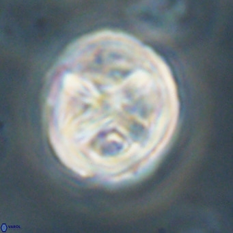 Chiphragmalithus calathus VR 30337