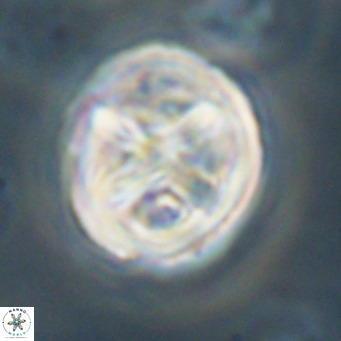 Chiphragmalithus calathus VR 30337