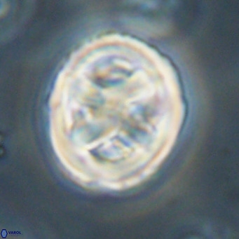 Chiphragmalithus calathus VR 30338