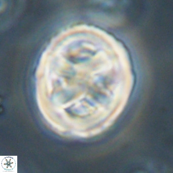 Chiphragmalithus calathus VR 30338