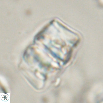 Chiphragmalithus calathus VR 30330