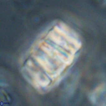 Chiphragmalithus calathus VR 30331