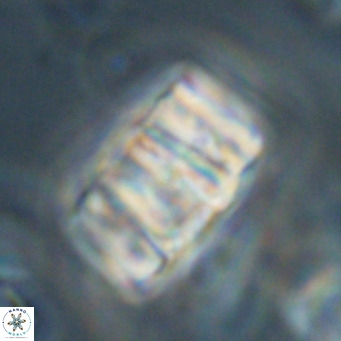 Chiphragmalithus calathus VR 30331