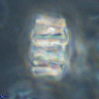 Chiphragmalithus calathus VR 30332