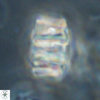 Chiphragmalithus calathus VR 30332